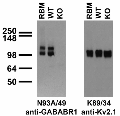 Anti-GABA-B-R1 Antibody