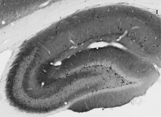 Anti-GABA-B-R1 Antibody - Image 2