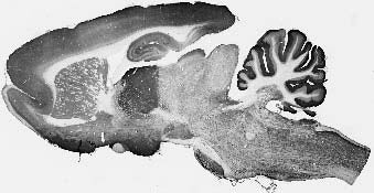 Anti-GABA-B-R1 Antibody - Image 3