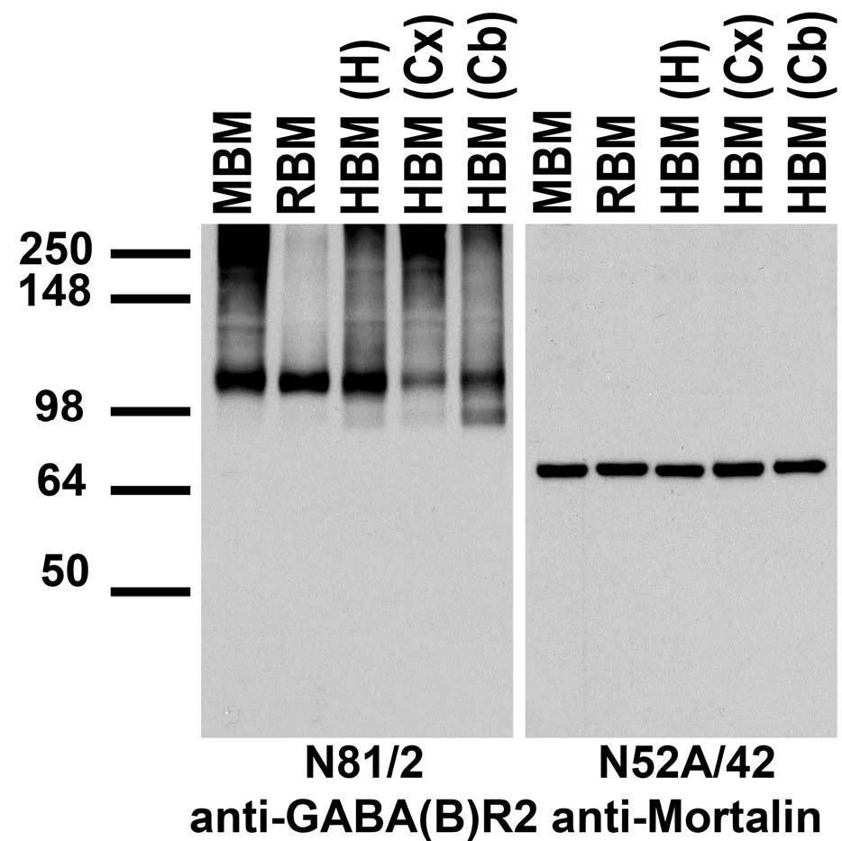 Anti-GABA-B-R2 Antibody