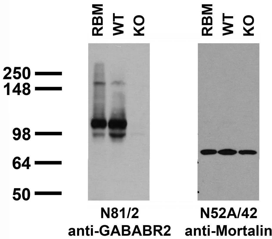 Anti-GABA-B-R2 Antibody - Image 2