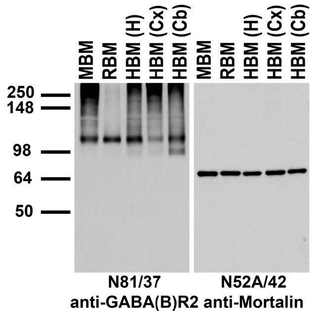 Anti-GABA-B-R2 Antibody