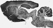 Anti-GABA-B-R2 Antibody - Image 2