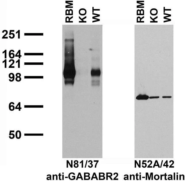 Anti-GABA-B-R2 Antibody - Image 4