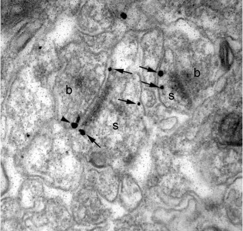 Anti-GABA-B-R2 Antibody - Image 5
