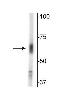 Anti-GABA Transporter (GAT) 2 Antibody