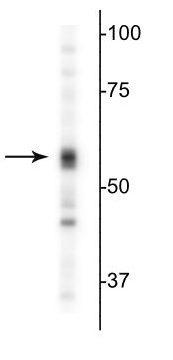Anti-GABAA Receptor α5 Antibody