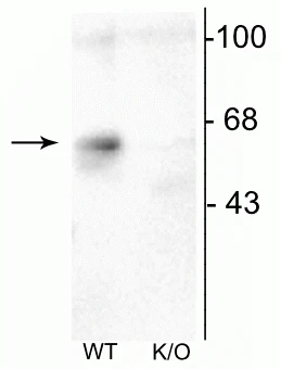 Anti-GABAA Receptor α6 Antibody