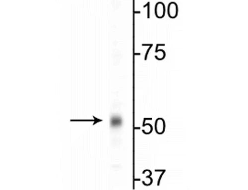 Anti-GABAA Receptor ß1 Antibody