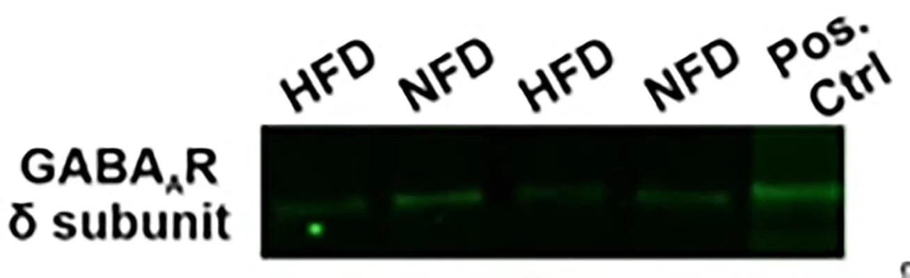 Anti-GABAA Receptor δ, N-Terminus Antibody - Image 3