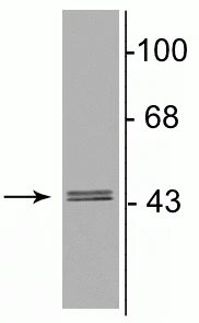 Anti-GABAA Receptor γ2 Antibody