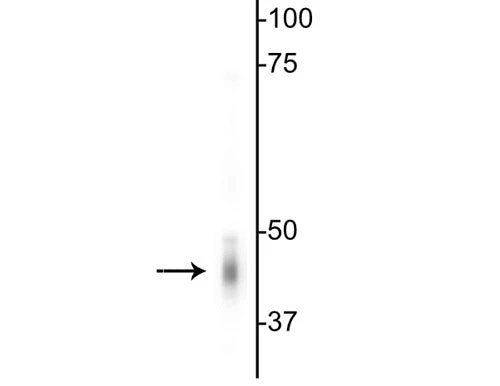 Anti-GABAA Receptor γ2 Antibody