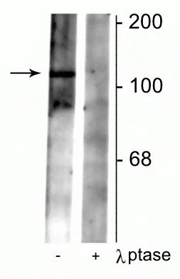 Anti-GABAB Receptor (Ser783), R2-Subunit Antibody