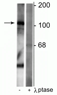 Anti-GABAB Receptor (Ser923), R1-Subunit Antibody