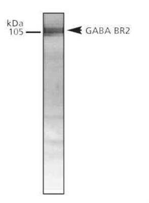 Anti-GABABR2 Antibody