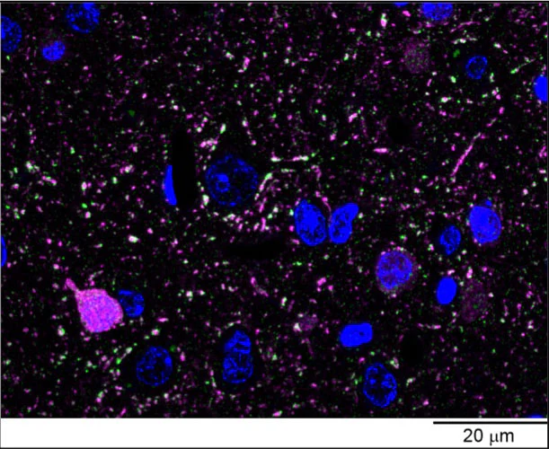 Anti-GAD67 Antibody