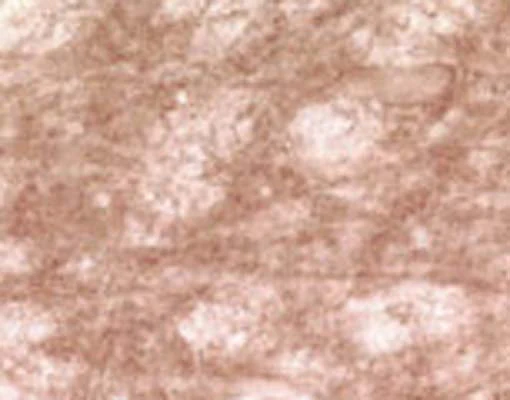 Anti-Gamma-synuclein Antibody