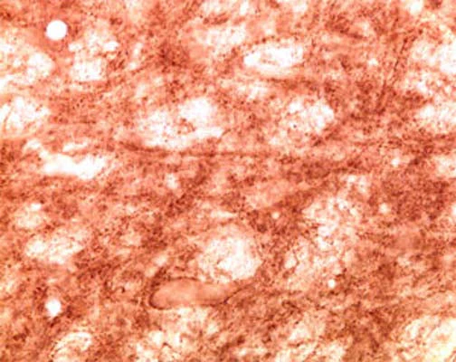 Anti-Gamma-synuclein Antibody - Image 2