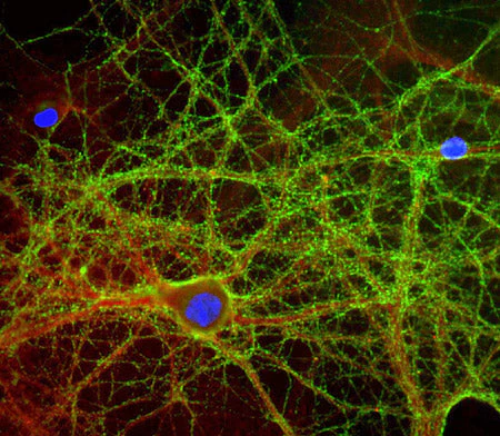 Anti-GAP43 Antibody - Image 2