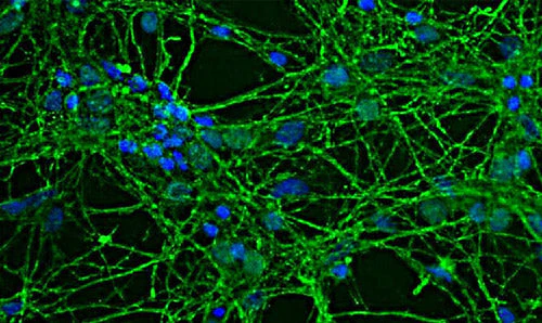 Anti-GAP43 Antibody - Image 3