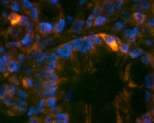 Anti-Gastrin Antibody