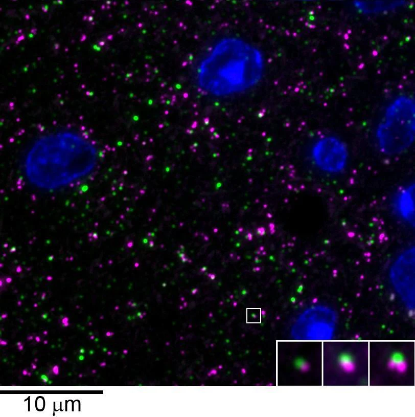 Anti-Gephyrin Antibody