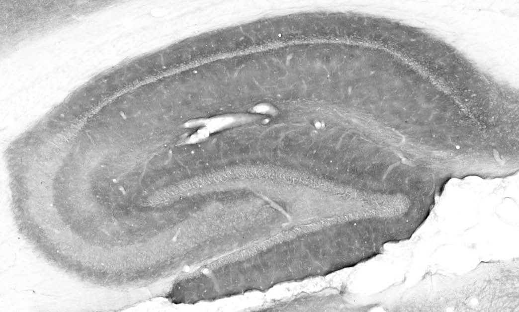 Anti-Gephyrin Antibody - Image 2