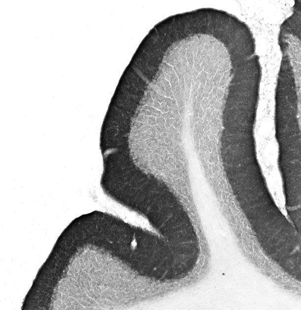 Anti-Gephyrin Antibody - Image 3