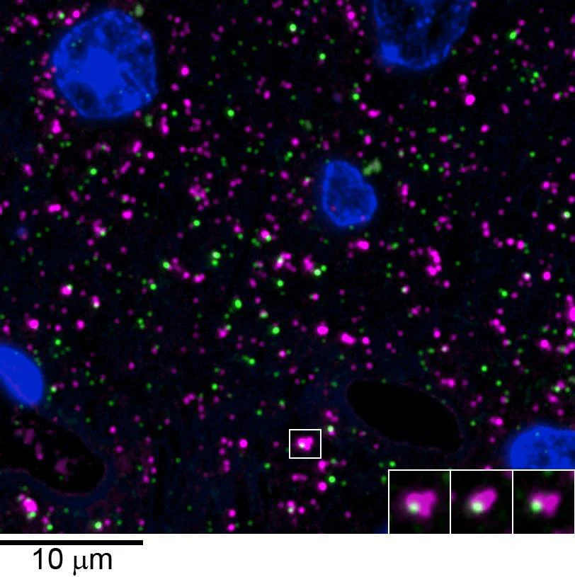Anti-Gephyrin Antibody
