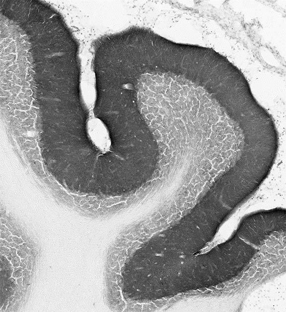 Anti-Gephyrin Antibody - Image 2