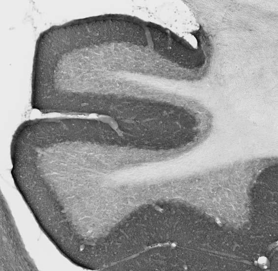 Anti-Gephyrin Antibody - Image 2