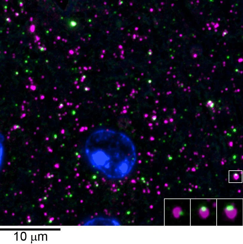 Anti-Gephyrin Antibody - Image 4