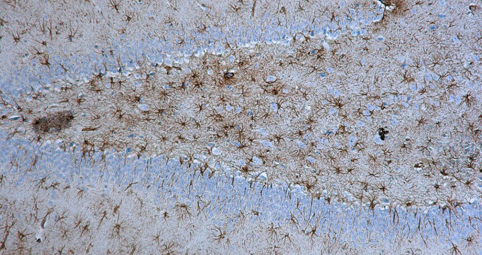 Anti-GFAP Antibody - Image 11