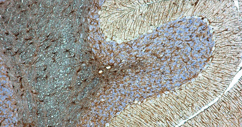 Anti-GFAP Antibody - Image 12