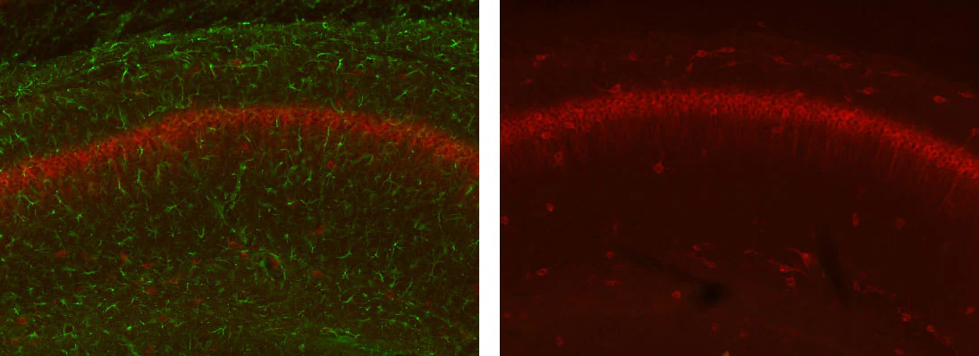 Anti-GFAP Antibody - Image 2