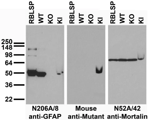 Anti-GFAP Antibody - Image 3