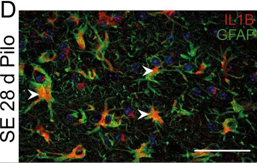 Anti-GFAP Antibody - Image 4