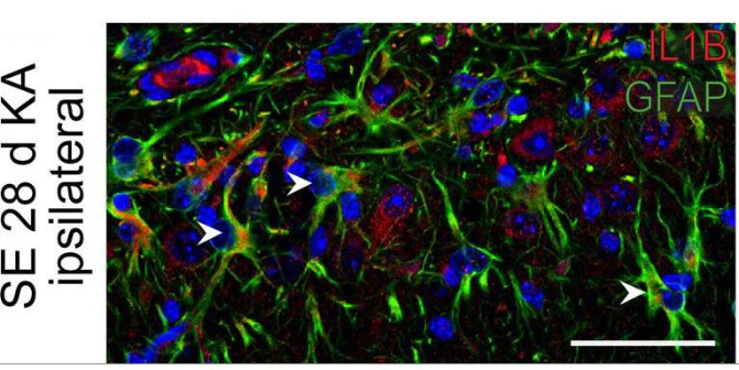 Anti-GFAP Antibody - Image 5