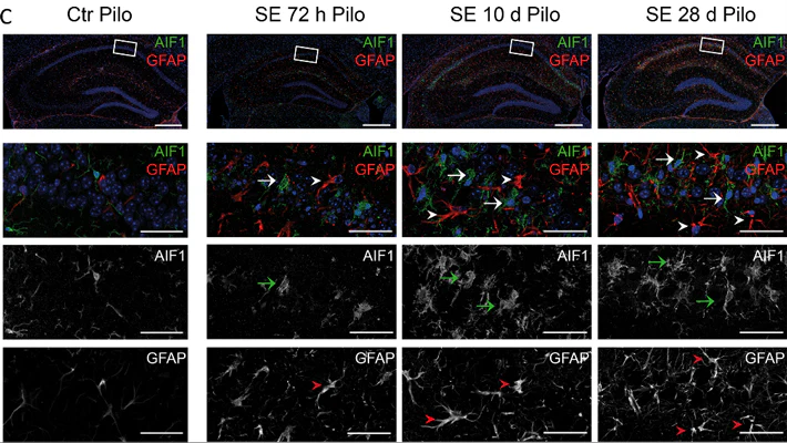 Anti-GFAP Antibody - Image 6