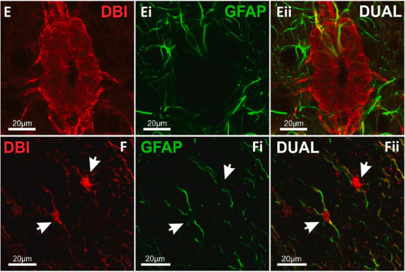 Anti-GFAP Antibody - Image 7