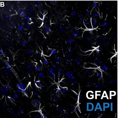 Anti-GFAP Antibody - Image 8