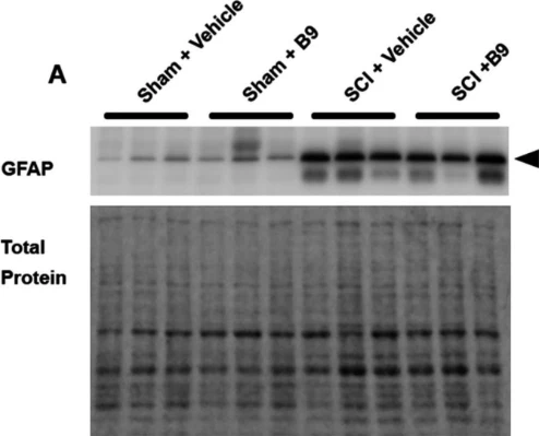 Anti-GFAP Antibody - Image 9