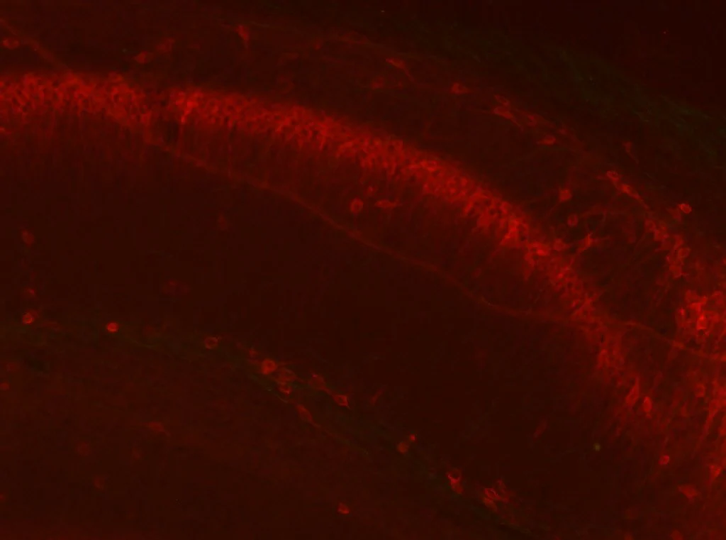 Anti-GFAP-R416WT Antibody