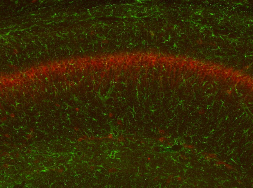 Anti-GFAP-R416WT Antibody - Image 2