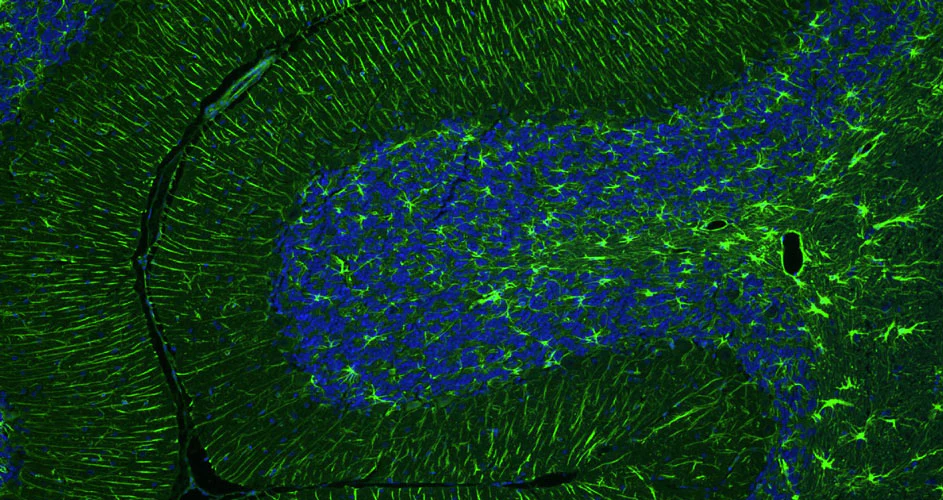Anti-GFAP Recombinant Guinea Pig Chimeric mAb