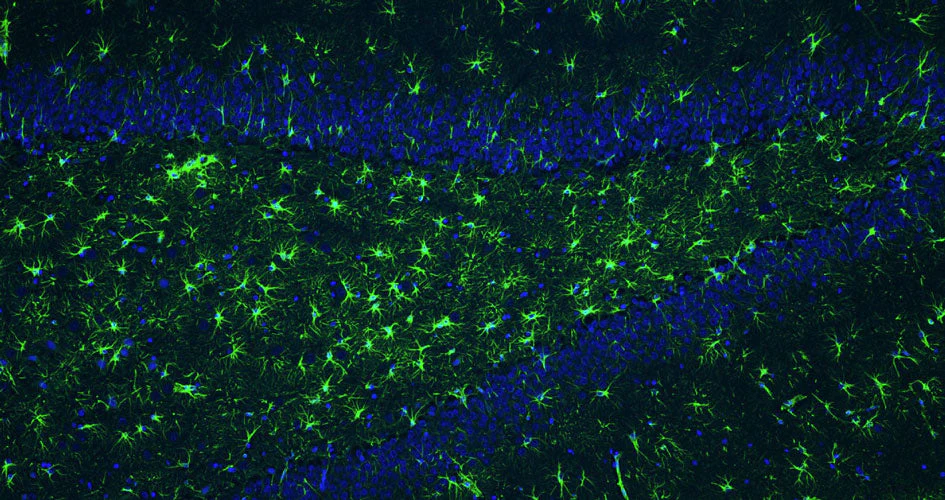 Anti-GFAP Recombinant Guinea Pig Chimeric mAb - Image 3