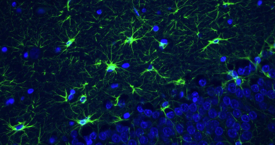Anti-GFAP Recombinant Guinea Pig Chimeric mAb - Image 4