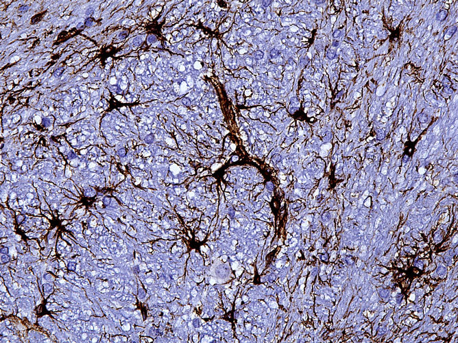 Anti-GFAP Recombinant Chicken Chimeric mAb - Image 4