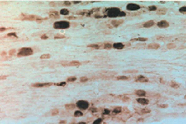 Anti-GFR alpha-2 Antibody