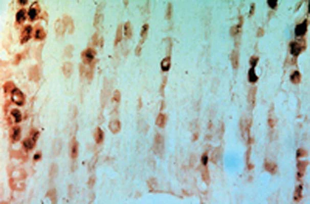 Anti-GFR alpha-3 Antibody